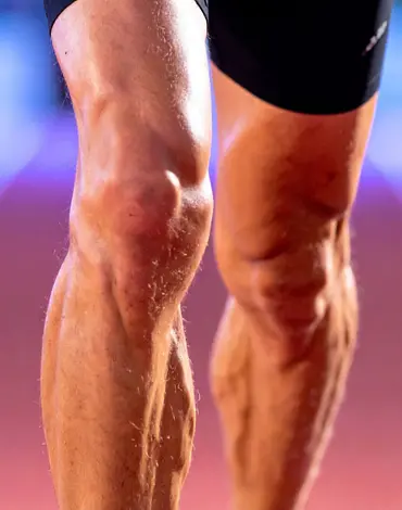 calf muscle shortening