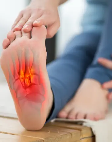 plantar fasciitis (1)