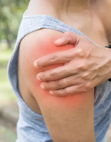 rotator cuff calcification