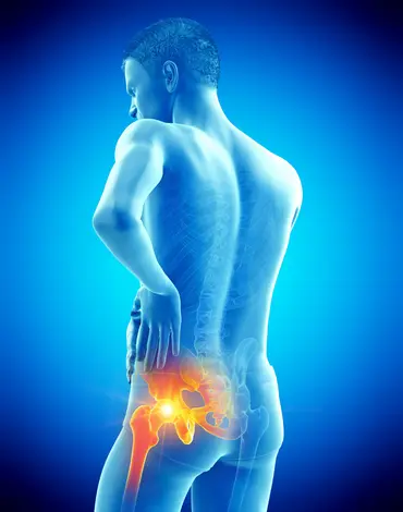 Sciatica and Nerve Pain